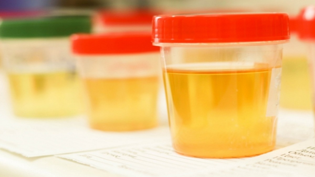 Best Synthetic Urine To Pass A Drug Test Fake Urine Reviews & Usage Guide