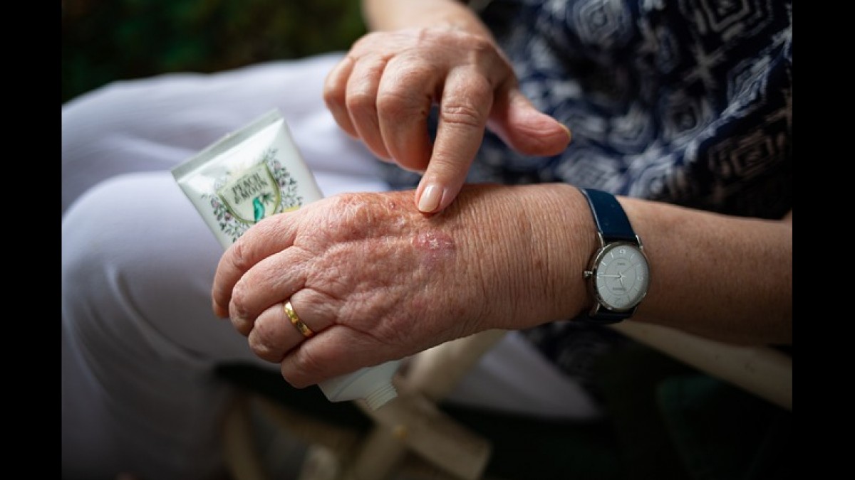 The Best Arthritis Supplement 2023 - Vimarsana News