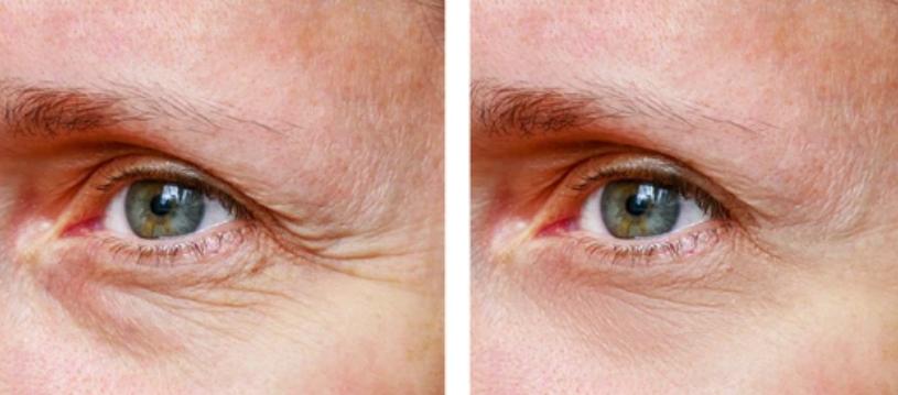 Eye Cream for Wrinkles Eye Cream for Wrinkles