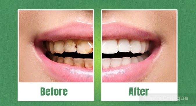 Before and After Before and After