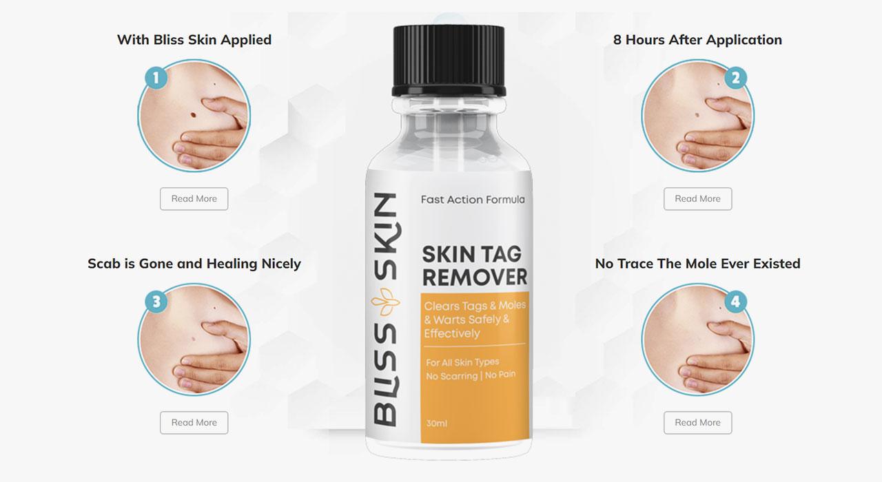 Bliss Skin Tag Remover Reviews Shocking Customer Side Effects & Negative Complaints